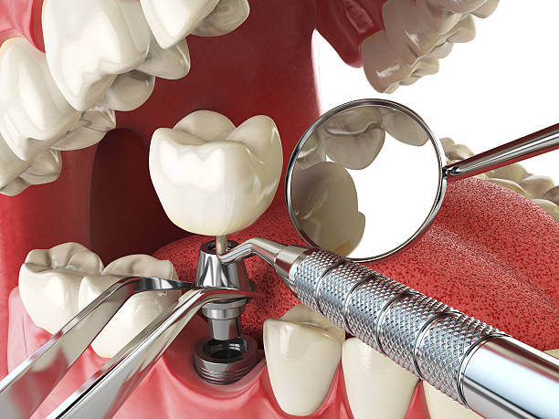 Best Emergency Dental Surgery in Lebanon, OR